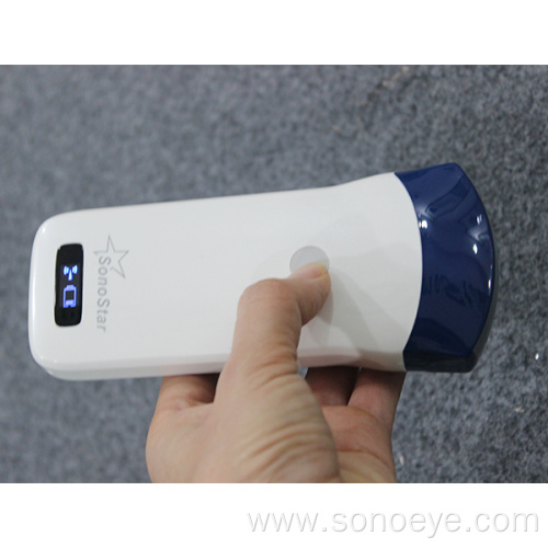 SONOSTAR Best Selling Wireless Ultrasound Probe